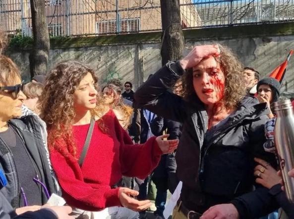 “Non mi sento tanto bene”. Manganellate davanti alla sede Rai di Napoli a chi protestava contro il comunicato dell’ Ad Rai contro Ghali.