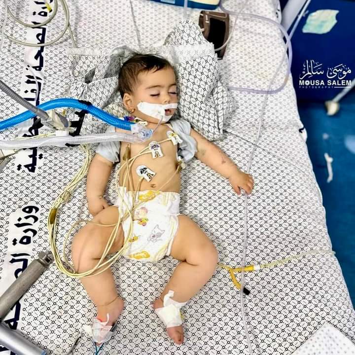 Gaza, la piccola Samira unica sopravvissuta nella famiglia alle bombe israeliane (Alessandro Di Battista)